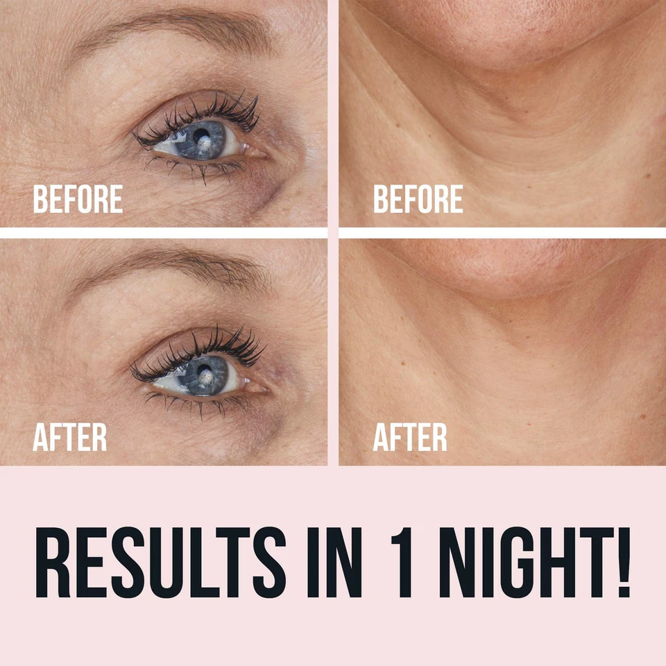 Sio Beauty Anti Aging Skin Treatment Patches For Neck Forehead And Smile Lines - Image 2 of 4