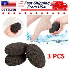 3 Pack Natural Lava Foot Pumice Stone For Feet Pedicure Tools Hard Skin Callus