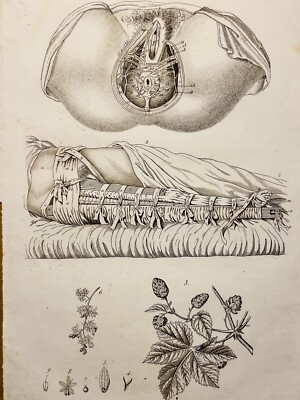 Antiquarische Kupferstisch 1834 Anatomie Medizine Krankheiten Arzt Tattoo Skizze