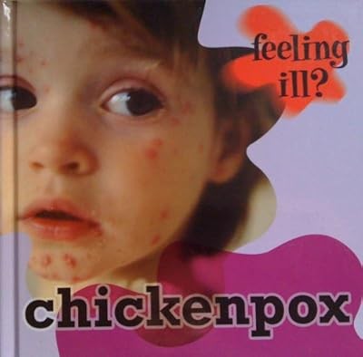 Chicken Pox (Feeling Ill?), Jillian Powell, Used; Good Book