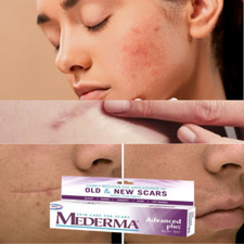 Advanced Plus Scar Treatment Gel for SCARS,ACNE,STRETCH MARKS 10g