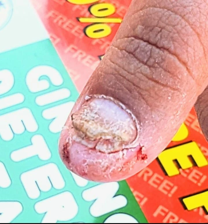 Hongos Hongo Get Out Foto 2 de 3