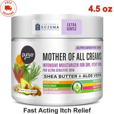 Eczema / Psoriasis Cream Natural Dermatitis Treatment, Itch Relief Plant-Based