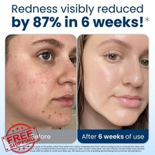 Clean Skin Club Clean Towels XL Disposable Face Towelettes 300 Ct