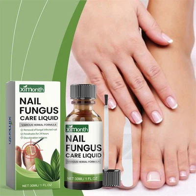 30ML Nail Treatment Fungus Kit Anti Fungal Toe Removal Care Liquid Solution - image 1 of 4