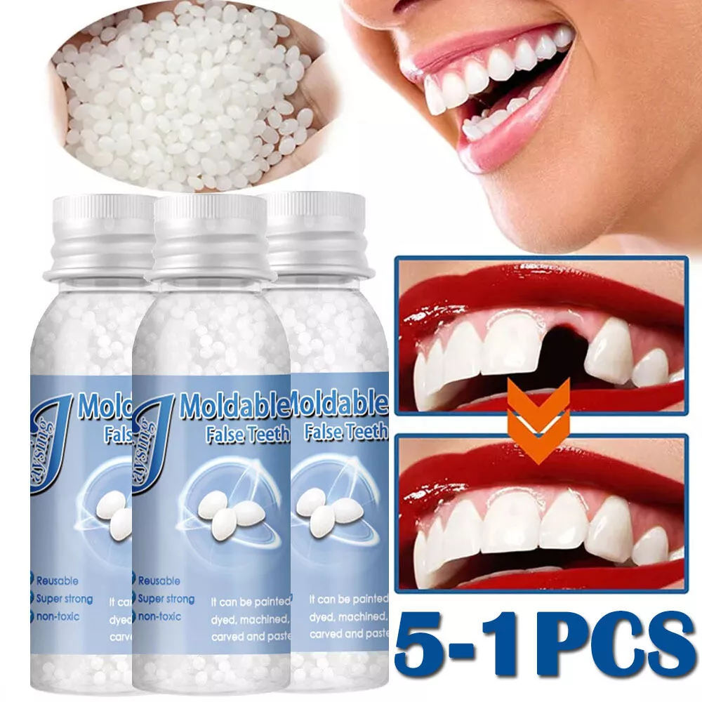 Tooth Repair Beads Tooth Glue Temporary Dental Glue for Teeth Filling  Reusable