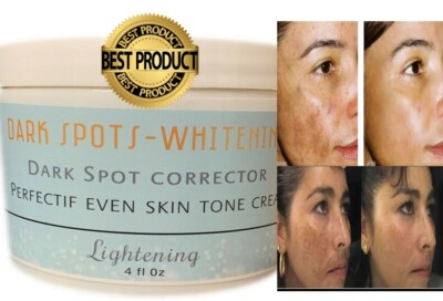 Dark Skin White cream corrector light fade freckles face support Acne 