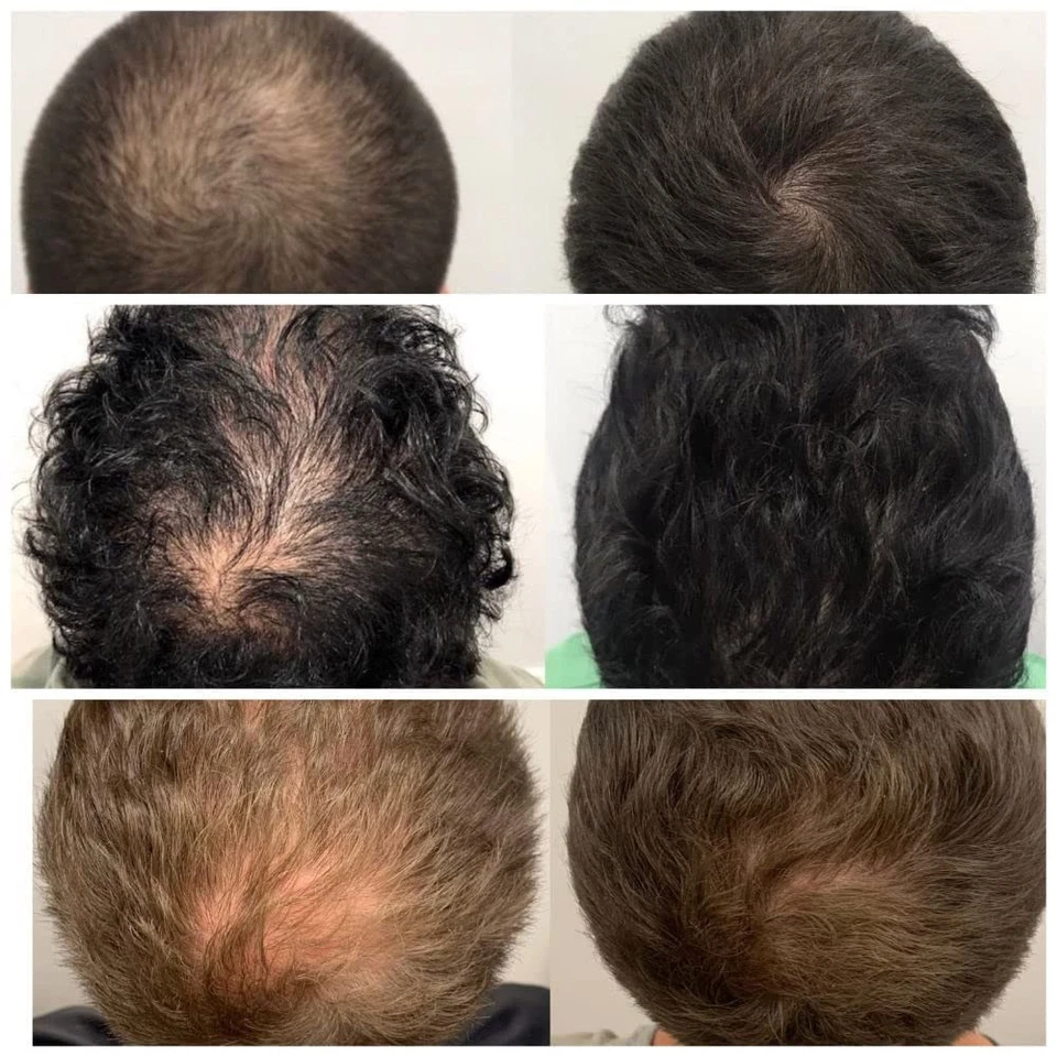 Tónico mágico para el crecimiento del cabello con ginseng - Tratamiento de pérdida de cabello 60 ml para hombres y mujeres, Foto 3 de 4