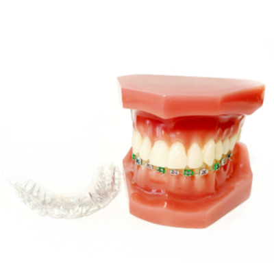 Dental Study Model Invisible Retainer Metal Brackets Contrast Aligner Comparison
