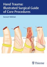 Hand Trauma: Illustrated Surgical Guide of Co...