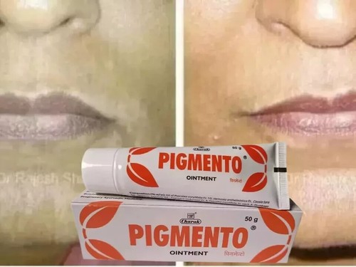 Charak PIGMENTO Ointment (50g) Herbal Ayurvedic Skin Wellness ( Pack of 5 ) - Picture 2 of 3