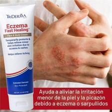 Crema Dermatitis Eczema Psoriasis Para Comezon Picazon Ronchas En La Piel Crema