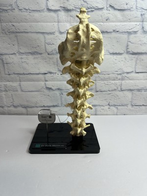 St Jude Medical Teaching Sample Display Eon  Anatomical Model Lumbar Human Spin