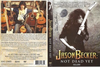 SIGNED/THUMBPRINTED Jason Becker DVD of Documentary JASON BECKER: NOT DEAD YET