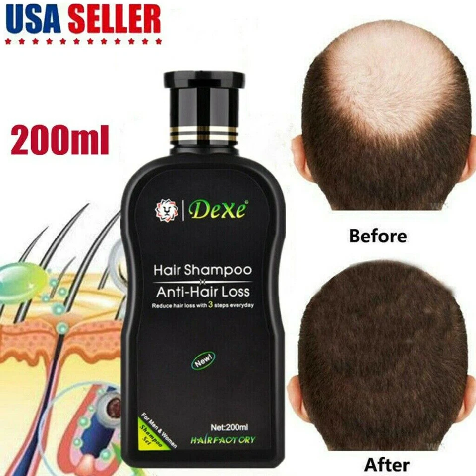 Hair Growth Shampoo Hair Regrowth Treatment Anti-Hair Loss Shampoo For Men Women - Image 3 of 4