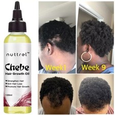 Chebe Hair Oil promote rapid hair growth and prevent breakage. 3.4oz