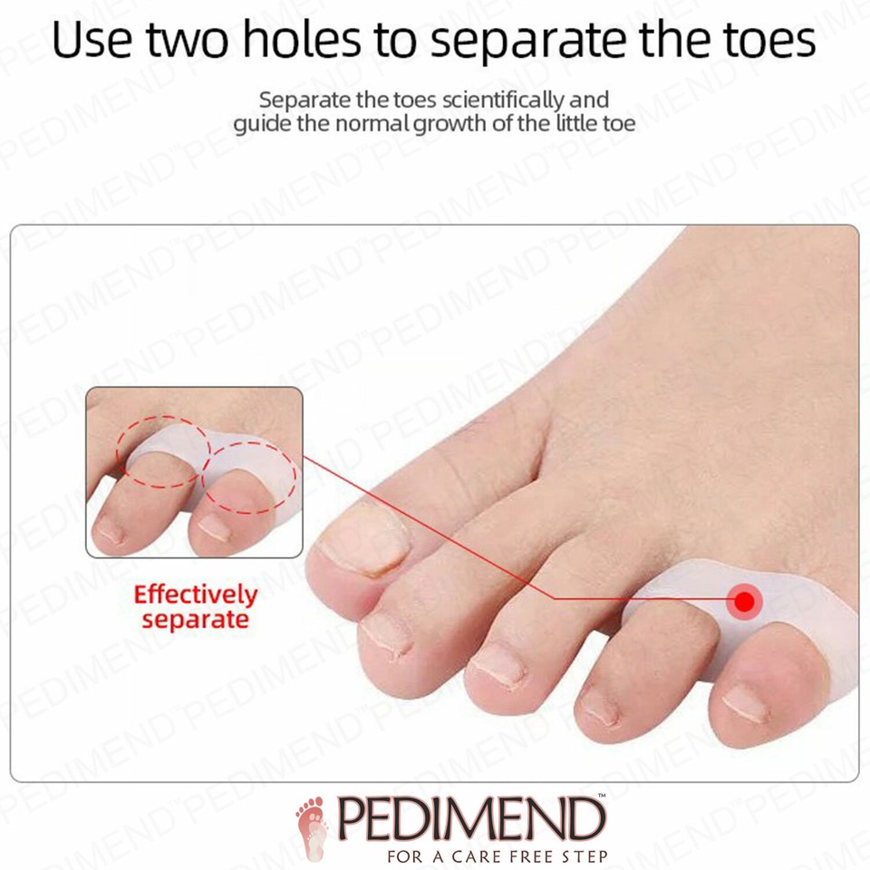 Pedimend Silicone Gel Pinky Allineamento Da Separatore - Foto 13