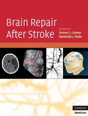 Brain Repair After Stroke - 9780521515337