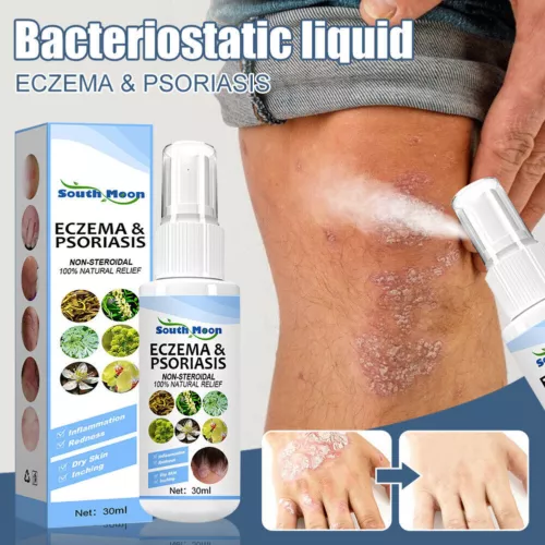 30ml Skin Psoriasis Spray Natural Herb Eczema Treatment Spray Itch Relief New - Picture 3 of 19