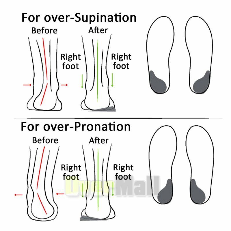 Supination – tagged Brand_Orthaheel – The Insole Store