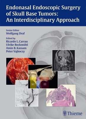 Endonasal Endoscopic Surgery of Skull Base Tumors: An Interdisciplinary App ...