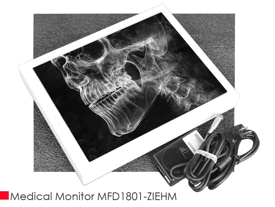 18,1" 18" 46cm MEDICAL HEALTH RÖNTGEN DISPLAY MONITOR MFD1801-ZIEHM C-BOGEN V899 - Bild 2 von 4