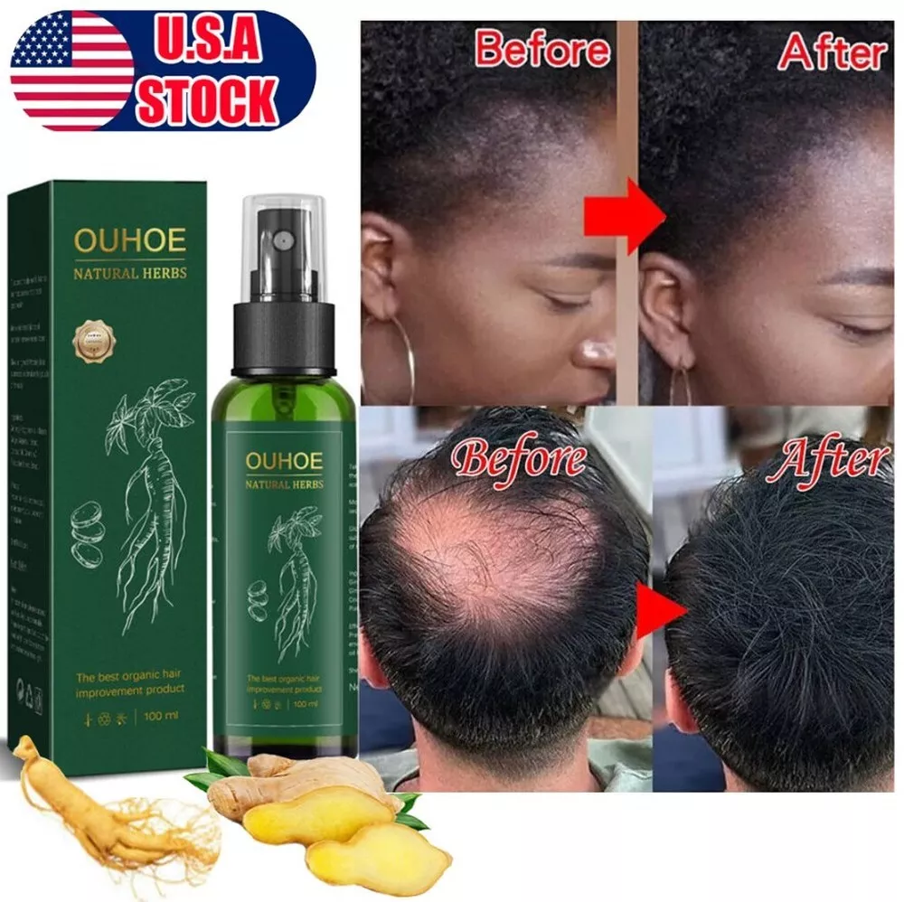 Best hair regrowth sale treatment