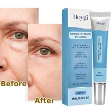Magic Eye Cream Instant Remove Eye Bag,Dark Circles,Wrinkle,Depuffing Firm Serum