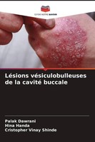 LéSions VéSiculobulleuses De La Cavité Buccale Cristopher Vinay Shinde