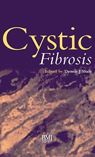 Cystic Fibrosis by Shale, Shale  New 9780727908261 Fast Free Shipp HB^+