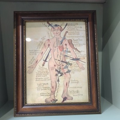 Wundmann Kunstdruck gerahmt. Antikes Bild Claudius Galen Anathomia 25,3 cm