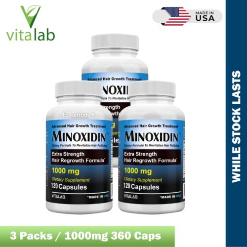MINOXIDINA 1000mg Crecimiento del Cabello 120 Comprimidos Extra Fuerza Hombres Mujeres Recrecimiento EE. UU. - Imagen 19 de 21