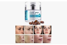 Crema Blanqueadora Para Elimina Manchas Y Acne De La Cara Crema Efectiva