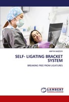SELF- Ligating Bracket System Breaking Free From Ligatures Anfiya Nazeer Buch