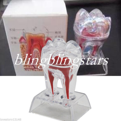 Base de cristal dental plástico duro extraíble dientes molar modelo suministro de estudio - Imagen 1 de 11