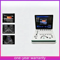 15" Portable Laptop Ultrasound Scanner Machine with Probes optional