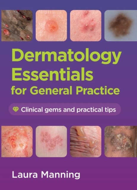 Dermatology Essentials for General Practice by Laura  Manning (Paperback Book)