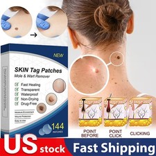 Skin Tag Remover Patches Quick Effective Mole and Wart Pad Removal Sticker US