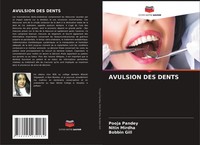 Pooja Pandey (U. A.) | Avulsion Des Dents | Taschenbuch | FranzöSisch (2021)