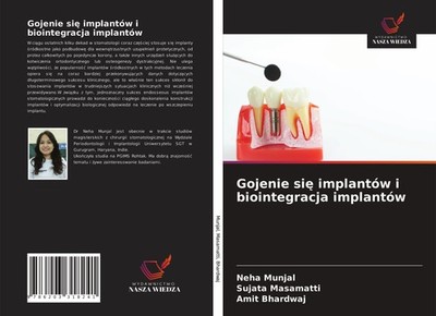 Gojenie si¿ implantów i biointegracja implantów Neha Munjal