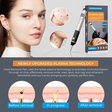Laser Plasma Pen Mole Removal Dark Spot Skin Tag Tattoo Wart Remover