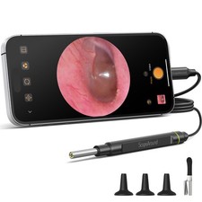 Otoscope with Light, 1080P FHD Ear Scope, 3.9mm Digital Otoscope Camera with ...