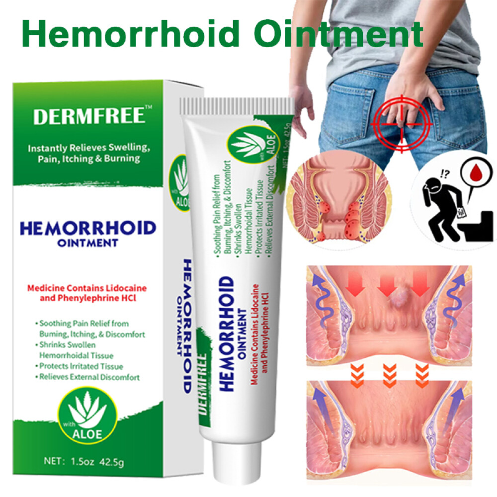 3PCS Hemorrhoids Remove Ointment Herbal Cream Relief Piles Pain Reduce Itching