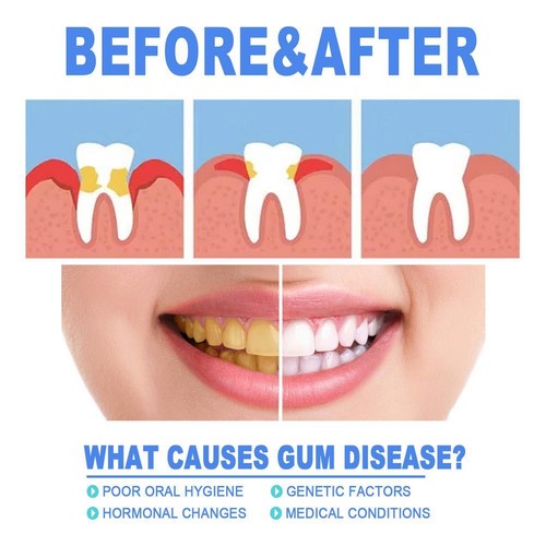 EEIHOE Gum Therapy Gel Gum Gel Dentizen 4ml - Bild 9 von 14