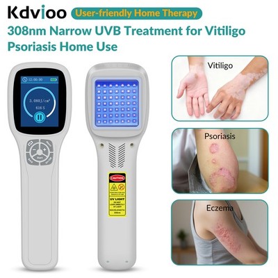 Clinical-Grade 308nm UVB Phototherapy Light Device for Managing Skin Disorders