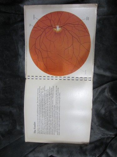 vintage Human Eye Anatomy clear clear plastic overlay .. - Foto 9 di 10