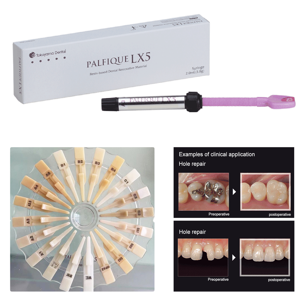 Palfique Tokuyama LX5 Resin Based Dental Restorative Composite 3.8