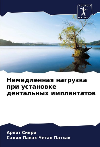Arpit Sikri (U. A.) | Nemedlennaq Nagruzka Pri Ustanowke Dental'nyh Implantatow-image