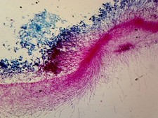 Penicillium; Whole-mount