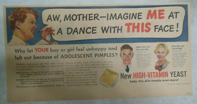 Fleischmann's Yeast Ad: Imagine Me At A Dance With This Pimple Face 1930's
